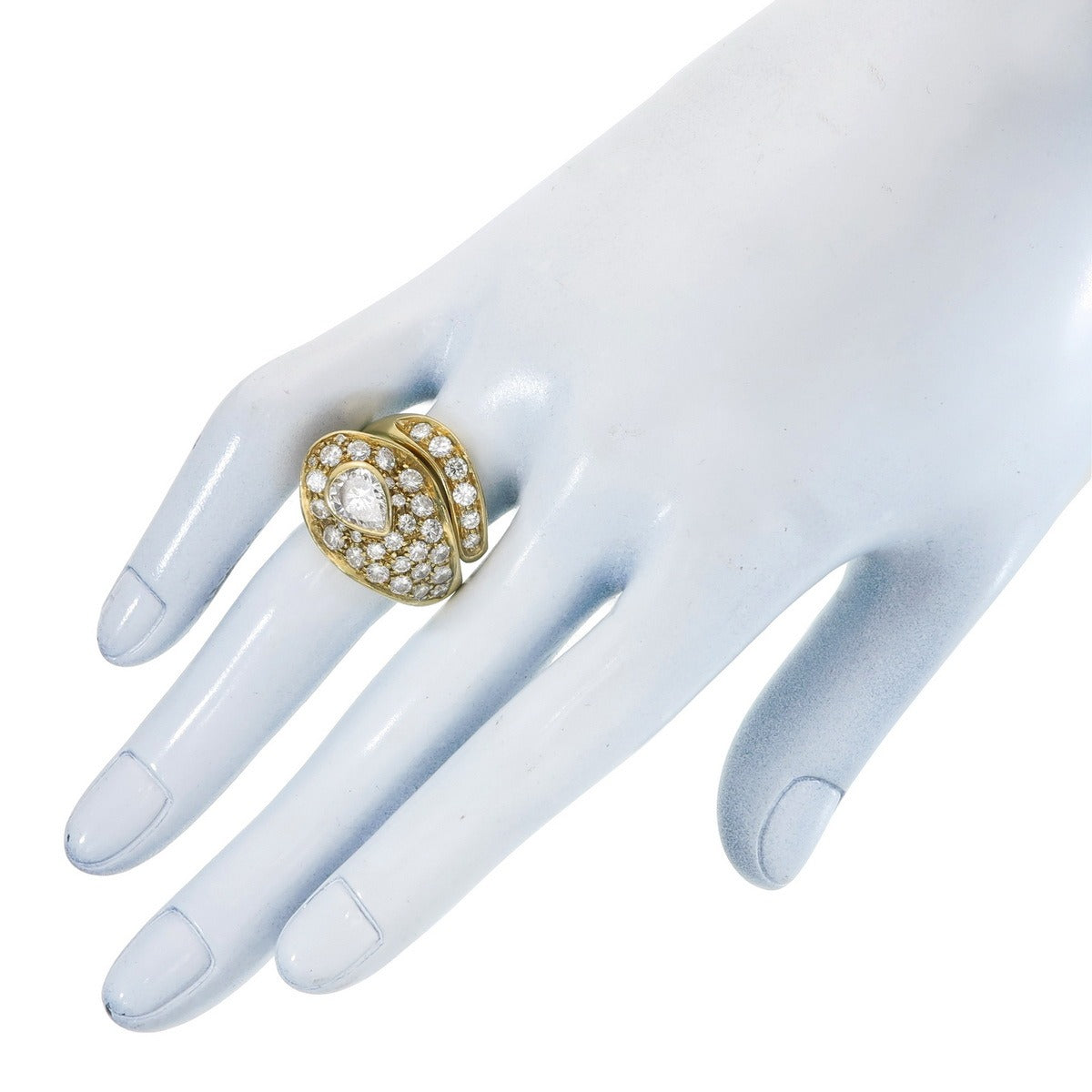 The Torsade Ring