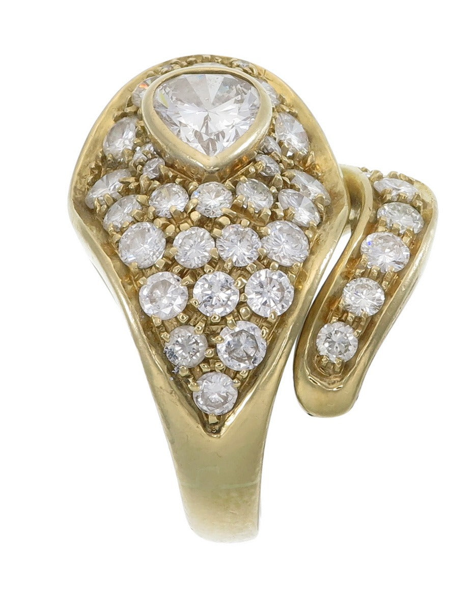 The Torsade Ring