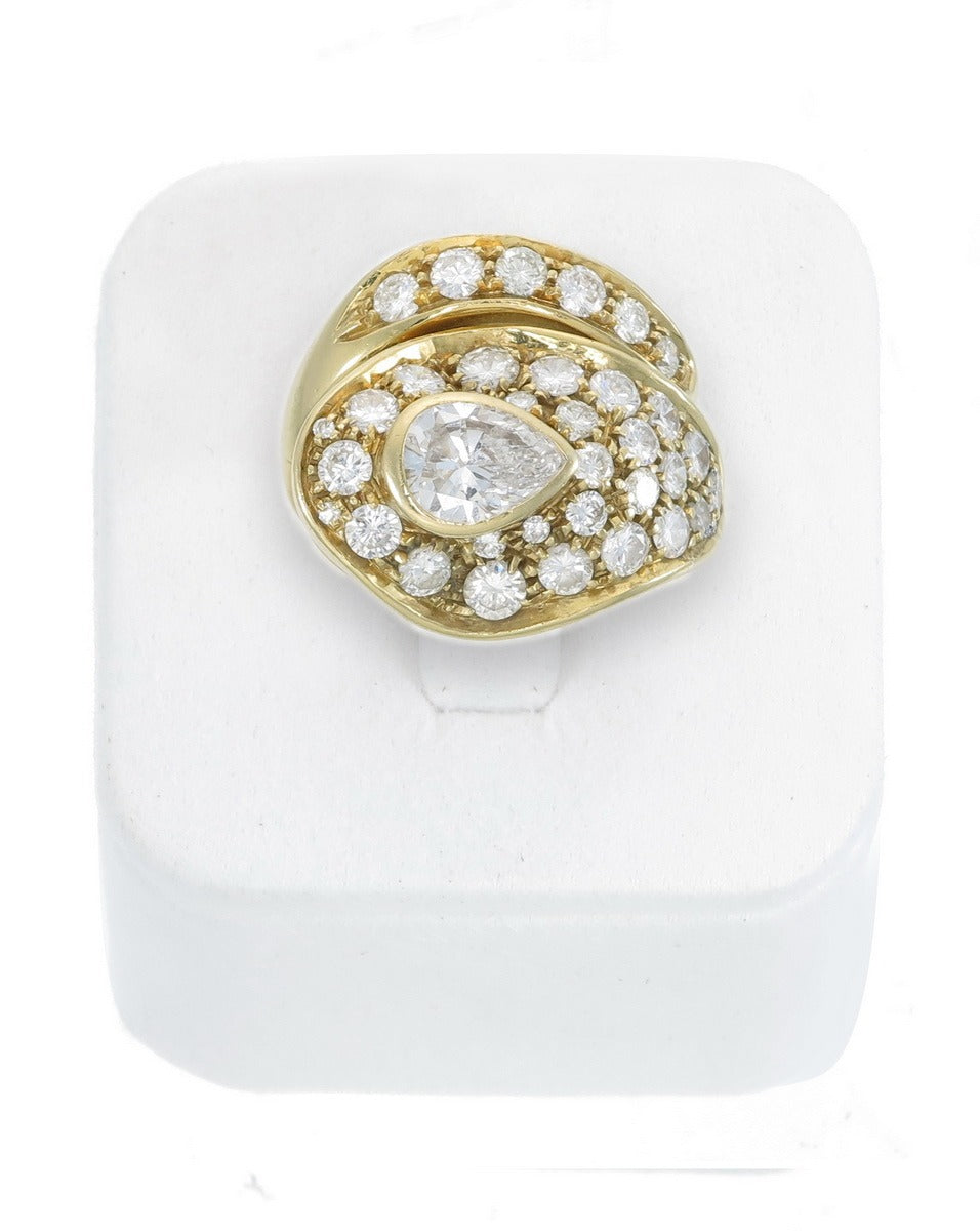 The Torsade Ring